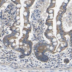 DDX26B Antibody, Novus Biologicals:Antibodies:Primary Antibodies